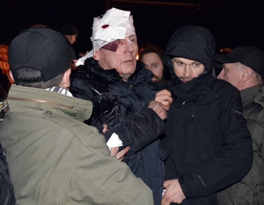 Lucenka hospitalizuotas po susirėmimo su milicijos specialiosiomis pajėgomis