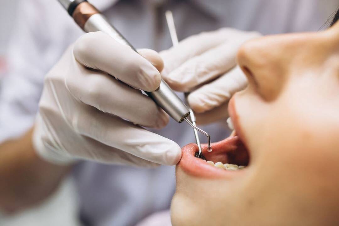 Jau galima kreiptis dėl kompensacijų už ortodontinius aparatus