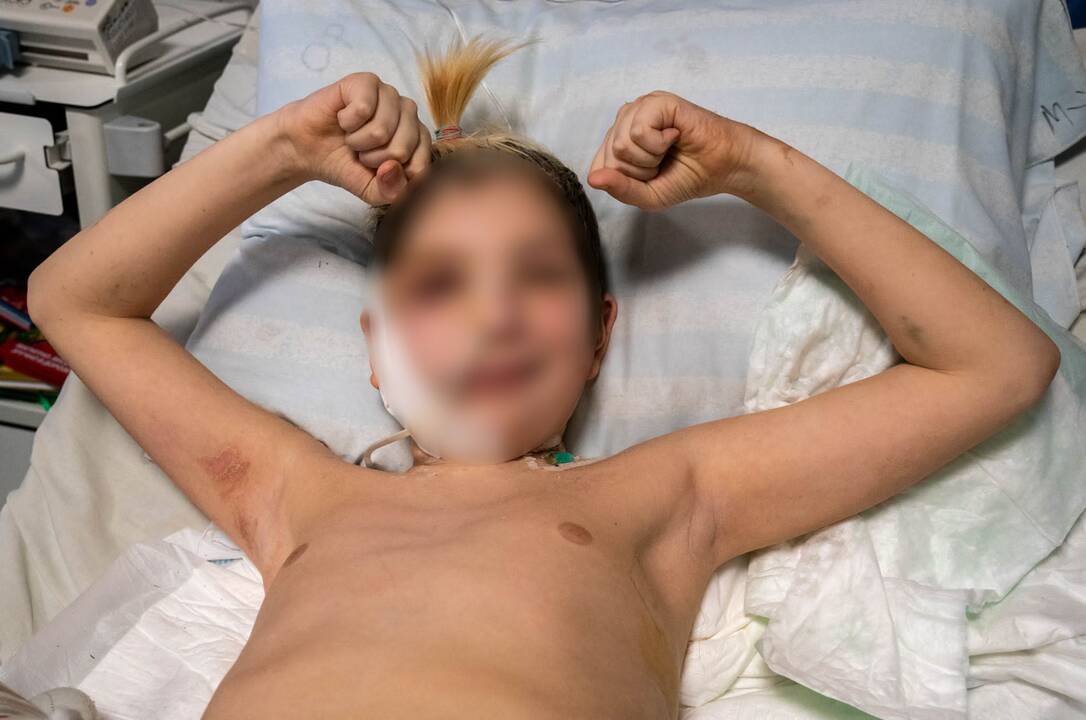 Ukrainos medikų kasdienybė: nuotraukos iš vaikų ligoninės Kyjive