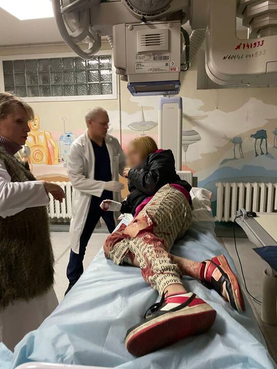 Ukrainos medikų kasdienybė: nuotraukos iš vaikų ligoninės Kyjive