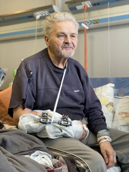 Ukrainos medikų kasdienybė: nuotraukos iš vaikų ligoninės Kyjive