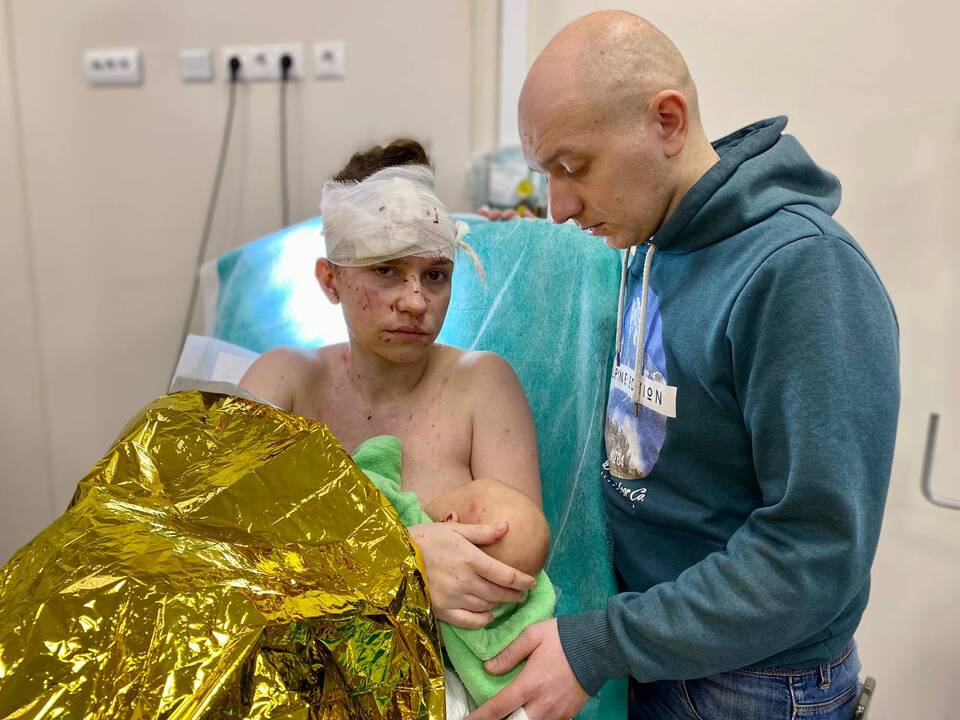 Ukrainos medikų kasdienybė: nuotraukos iš vaikų ligoninės Kyjive