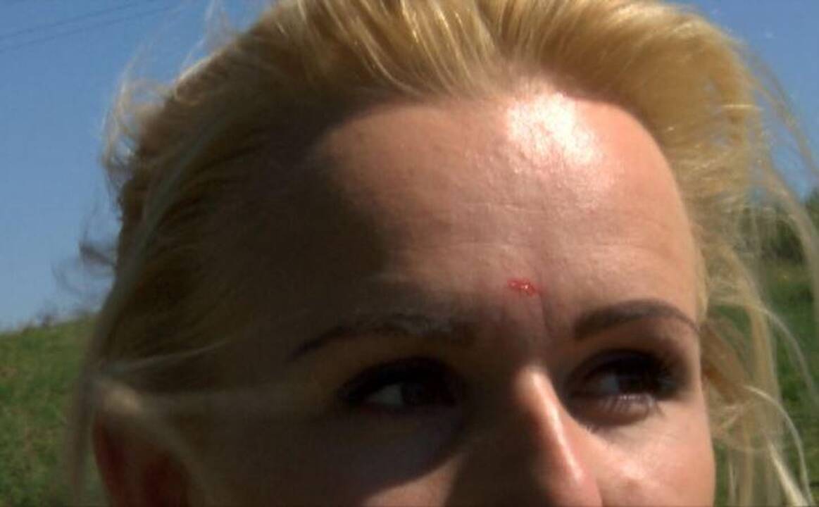 Laidos filmavimai baigėsi krauju: sužalota D. Baltrušaitytė