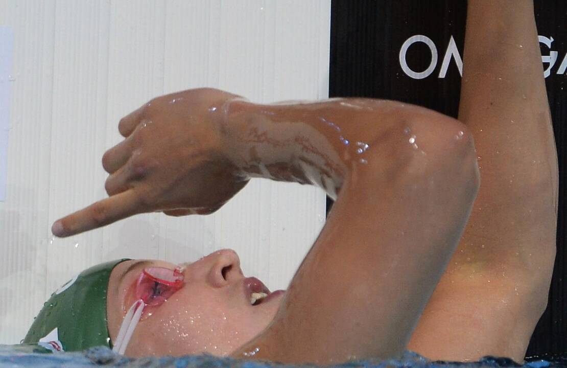 Rūta Meilutytė iškovojo aukso medalį