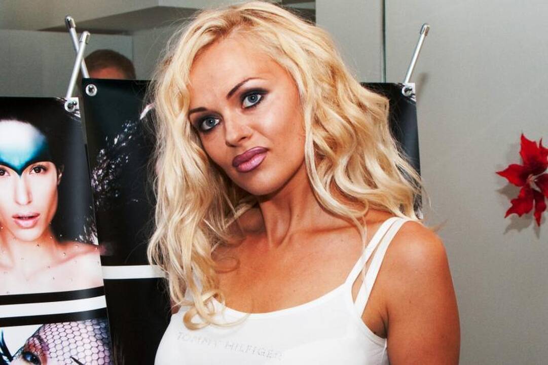 Jurgita Tvarijonaitė: kalbėti apie plastines operacijas – žemas lygis