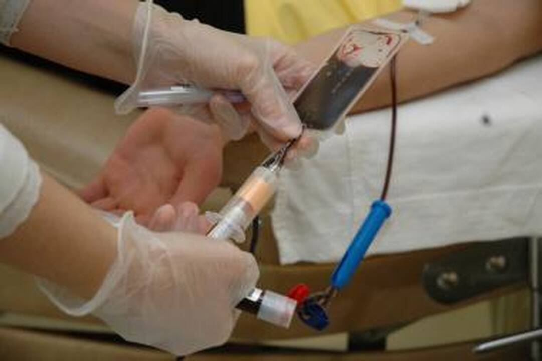 Pernai Lietuvoje padvigubėjo užsikrėtusiųjų ŽIV