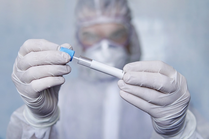 Ilgėjant eilėms prie testavimo punktų, ima „braškėti“ tyrimus atliekančios laboratorijos