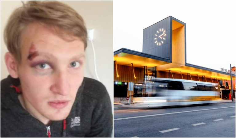 Sumuštas Dovydas