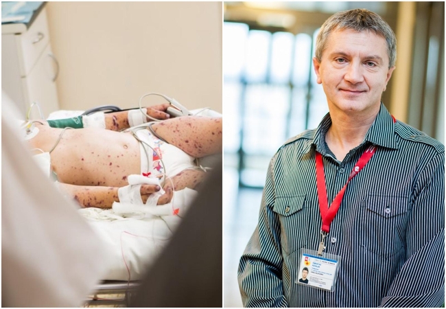 Profesorius apie klastingą infekciją: simptomai beveik nesiskiria nuo peršalimo ligos