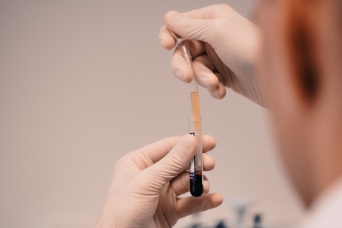 Retos inkstų ligos – diagnozavus jas laiku, pacientams galima padėti