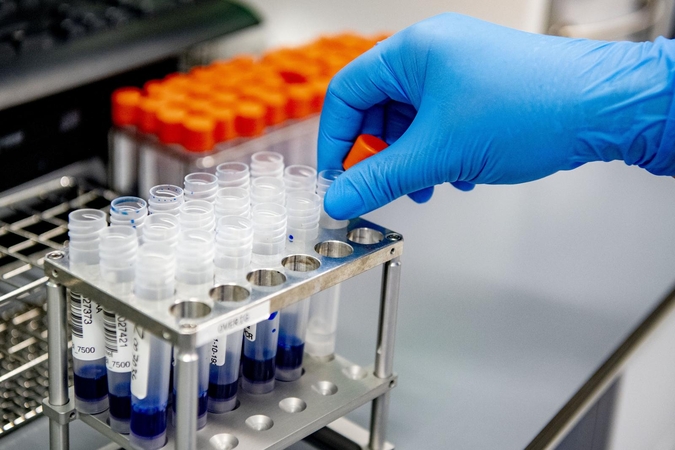 Daugiau nei 3 tūkst. ėminių laukia tyrimų – laboratorijos nespėja aprėpti srautų