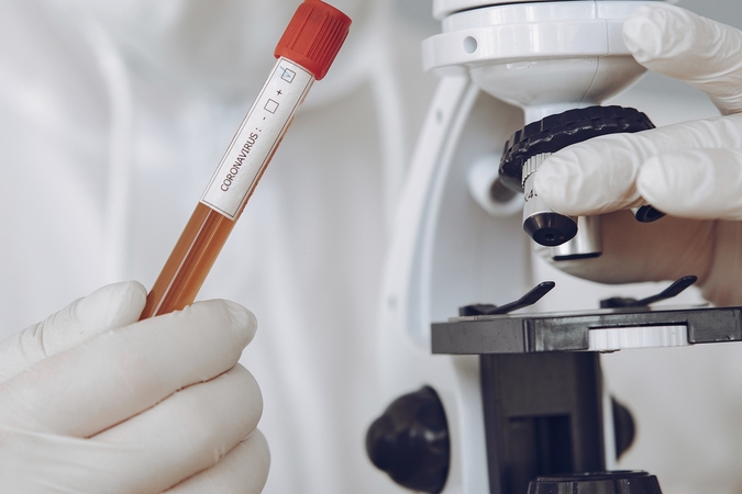 Serologinius tyrimus dėl COVID-19 leista atlikti ir nustatant buvusį susirgimą