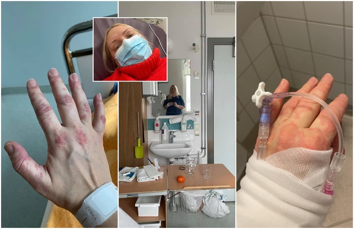 Koronavirusu persirgusiai Rūtai vėliau teko gultis į ligoninę: mano imunitetas pakvaišo