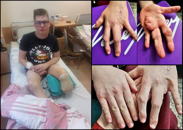 Reta liga sergančio vaikino būklė blogėja: suteikė vilties, o tada žodžių nebeliko