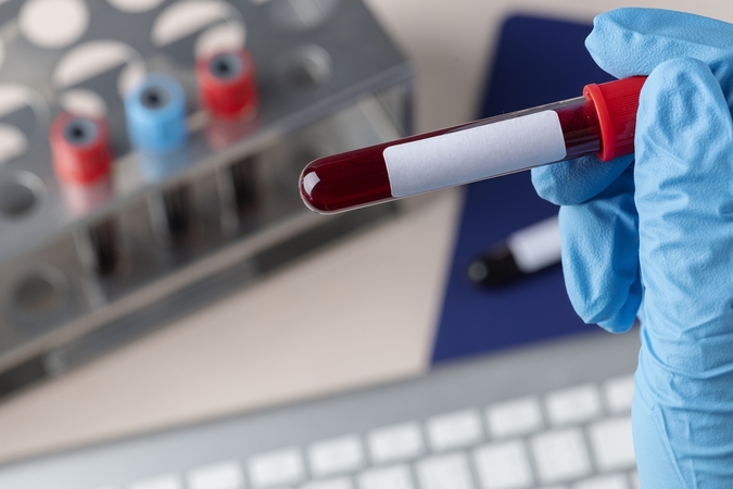 Gyventojai kviečiami aktyviau prevenciškai tirtis dėl vėžio