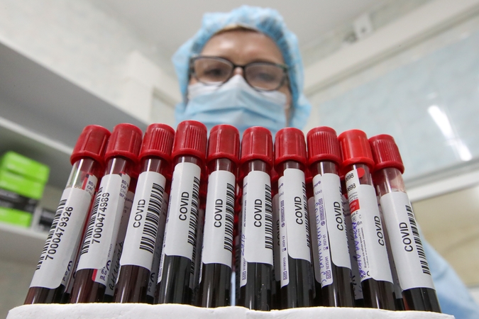 Profilaktiniai testavimai pagal epidemiologinius rodiklius – nuo pirmadienio