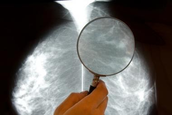 Lietuvoje vėžio diagnozę kasdien išgirsta beveik 50 žmonių