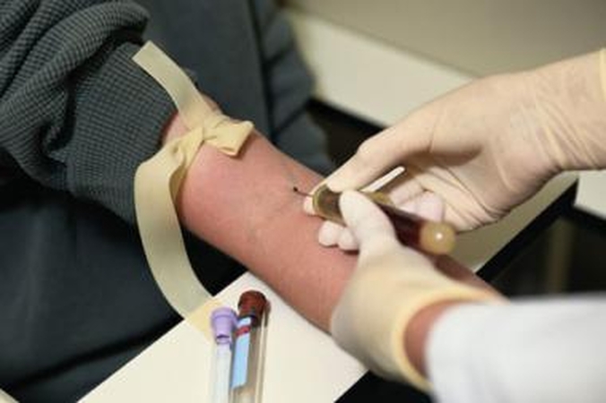 Prieš AIDS grėsmę – nemokamos patikros dėl ŽIV akcijos 