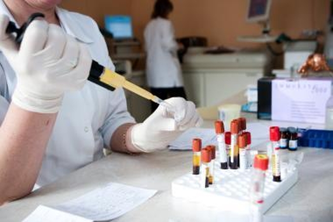 Pernai Lietuvoje diagnozuota 180 naujų ŽIV užsikrėtimo atvejų