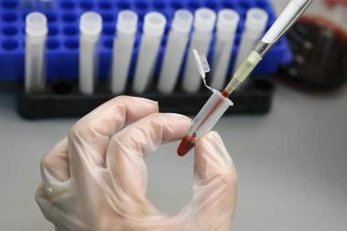 Pasaulinę AIDS dieną – nemokami tyrimai dėl ŽIV